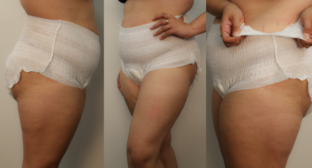 Why You Need Postpartum Underwear: Comfort, Support & Confidence After Birth